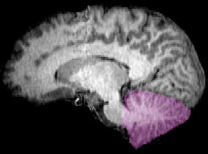 Figure 1b: MRI image showing a mid-sagittal view of the human brain, with the cerebellum in purple.