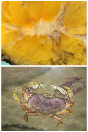 Breast cancer in a mastectomy specimen (top). The cancerous tumour (pale yellow) resembles the figure of a crab (bottom photo, by Chouby, Flickr), giving the disease its name.