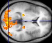 Since the 1980's, sophisticated neuroimaging procedures, such as fMRI (above), have furnished increasing knowledge about the workings of the human brain, shedding light on ancient philosophical problems.